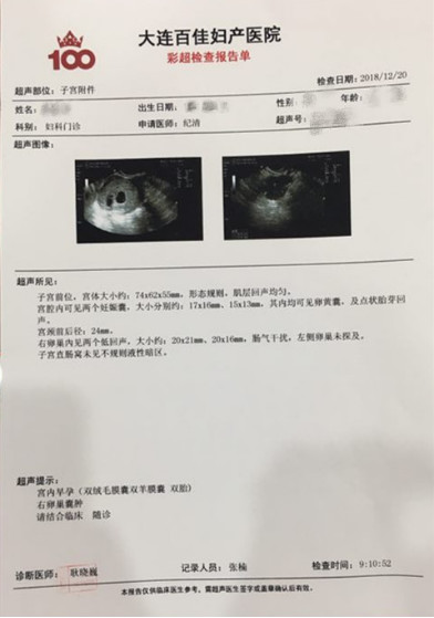 从不孕到喜怀双胎,多囊卵巢综合征患者的福音来了 从不孕到喜怀双胎,多囊卵巢综合征患者的福音来了