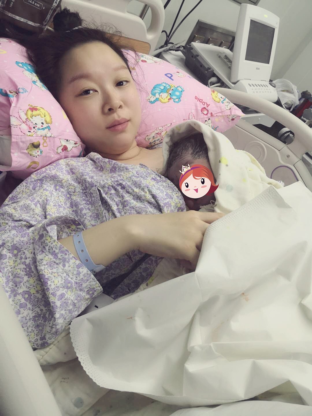 厉害!我院成功开展外倒转术,帮助臀位宝宝“华丽转身”! 厉害!我院成功开展外倒转术,帮助臀位宝宝“华丽转身”!