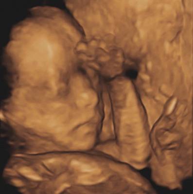 大连新百佳妇儿医院四维彩超医院